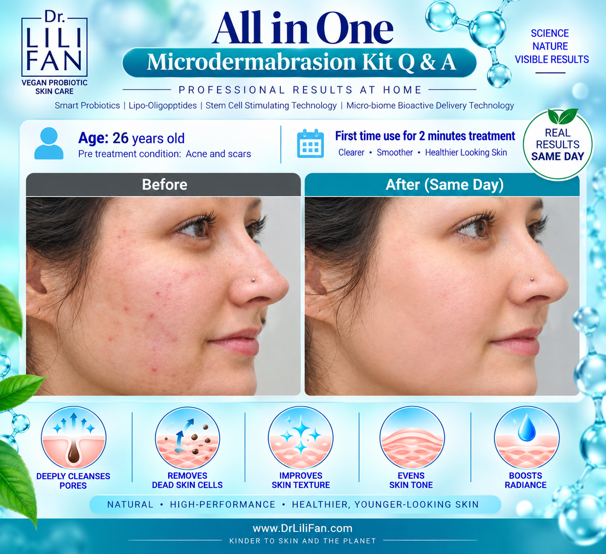 Probiotic All-in-One Microdermabrasion Kit