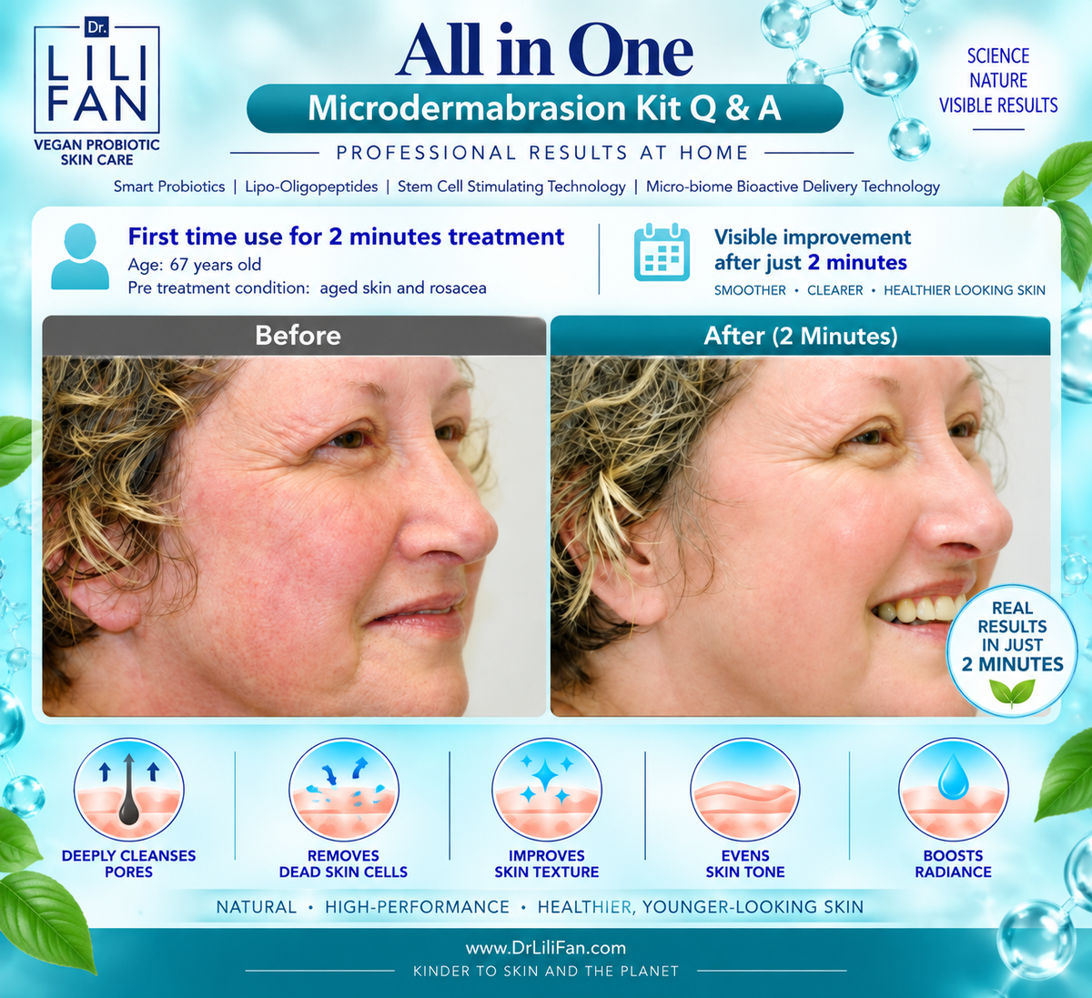 Probiotic All-in-One Microdermabrasion Kit